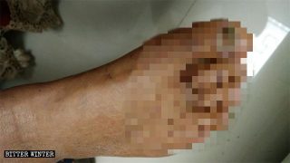 신앙 때문에 참혹한 고문을 당하는 신자들